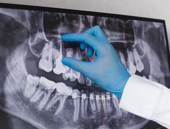 A dentist evaluating a patient's x-rays.
