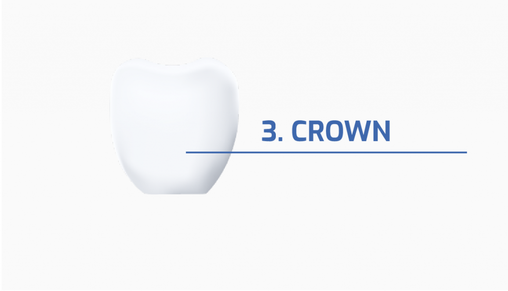 The dental implant custom crown.